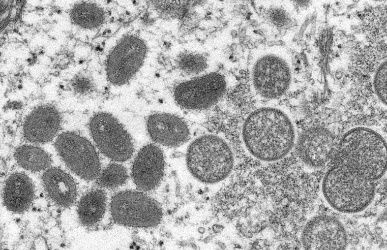🧫 São Paulo, Rio de Janeiro e RS concentram os 11 casos de varíola dos macacos no Brasil